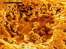 CSIRO ScienceImage 3908 Image couleur à balayage électronique de l'or bactérioforme sur un grain d'or de la mine Hit or Miss dans le nord du Queensland.jpg