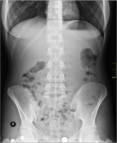 File:Medical X-Ray imaging RLN07 nevit.jpg