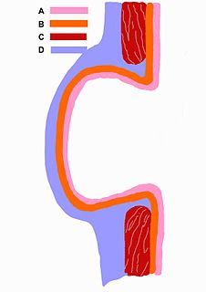 Diverticulum medical or biological term for an outpouching of a hollow (or a fluid-filled) structure in the body