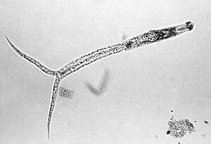 Dermatitis Per Cercàries