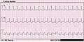 Pisipilt versioonist seisuga 29. aprill 2008, kell 21:09