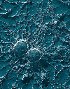 Staphylococcus aureus 50 000-kordses suurenduses