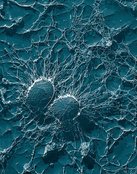 File:Staphylococcus aureus, 50,000x, USDA, ARS, EMU.jpg