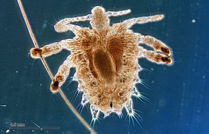 File:Crab louse (251 23) Female, from a human host.jpg