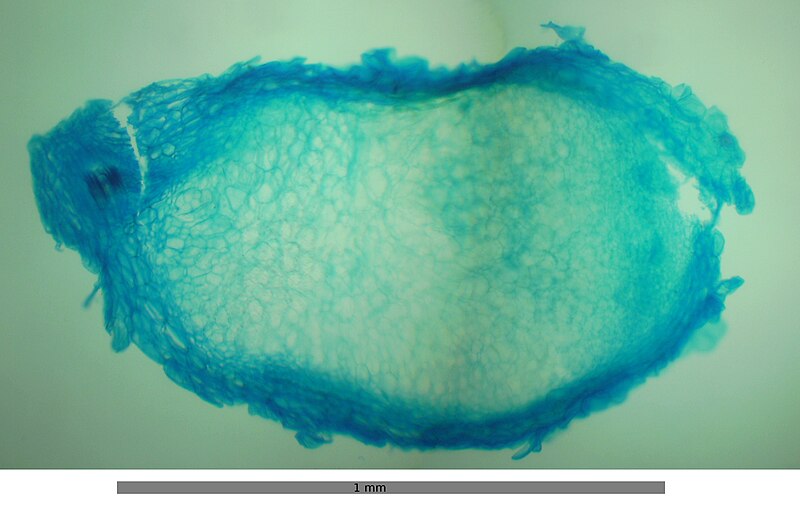 File:Cross-section through root nodule of (Vicia spec.).jpg