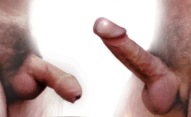 Thumb image