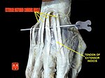 Extensor digitorum muscles.jpg