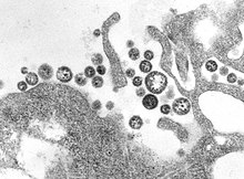 TEM micrograph of "Lassa mammarenavirus" virions