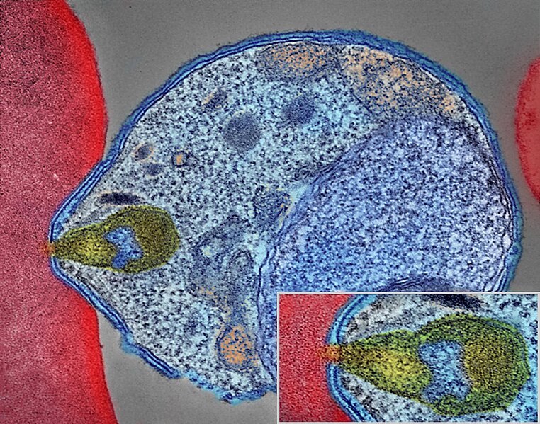 File:Malaria Parasite Connecting to Human Red Blood Cell (34034143483).jpg