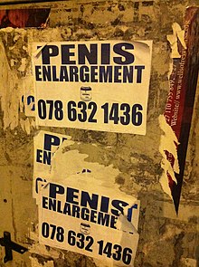 220px Penis Enlargement Sign in Johannesburg - Penis Enlargement