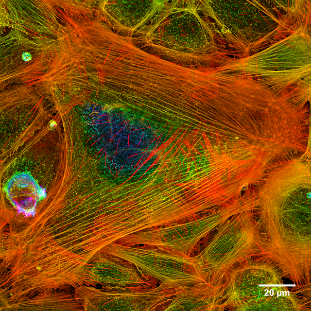תמונה של חלבוני שלד התא הקשורים לצובענים פלואורסצנטיים. נלקחה בשיטת מיקרוסקופיה קונפוקלית.