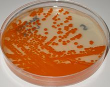 Streptococcus agalactiae on granada agar, anaerobic incubation Streptococcus agalactiae on Granada medium.jpg