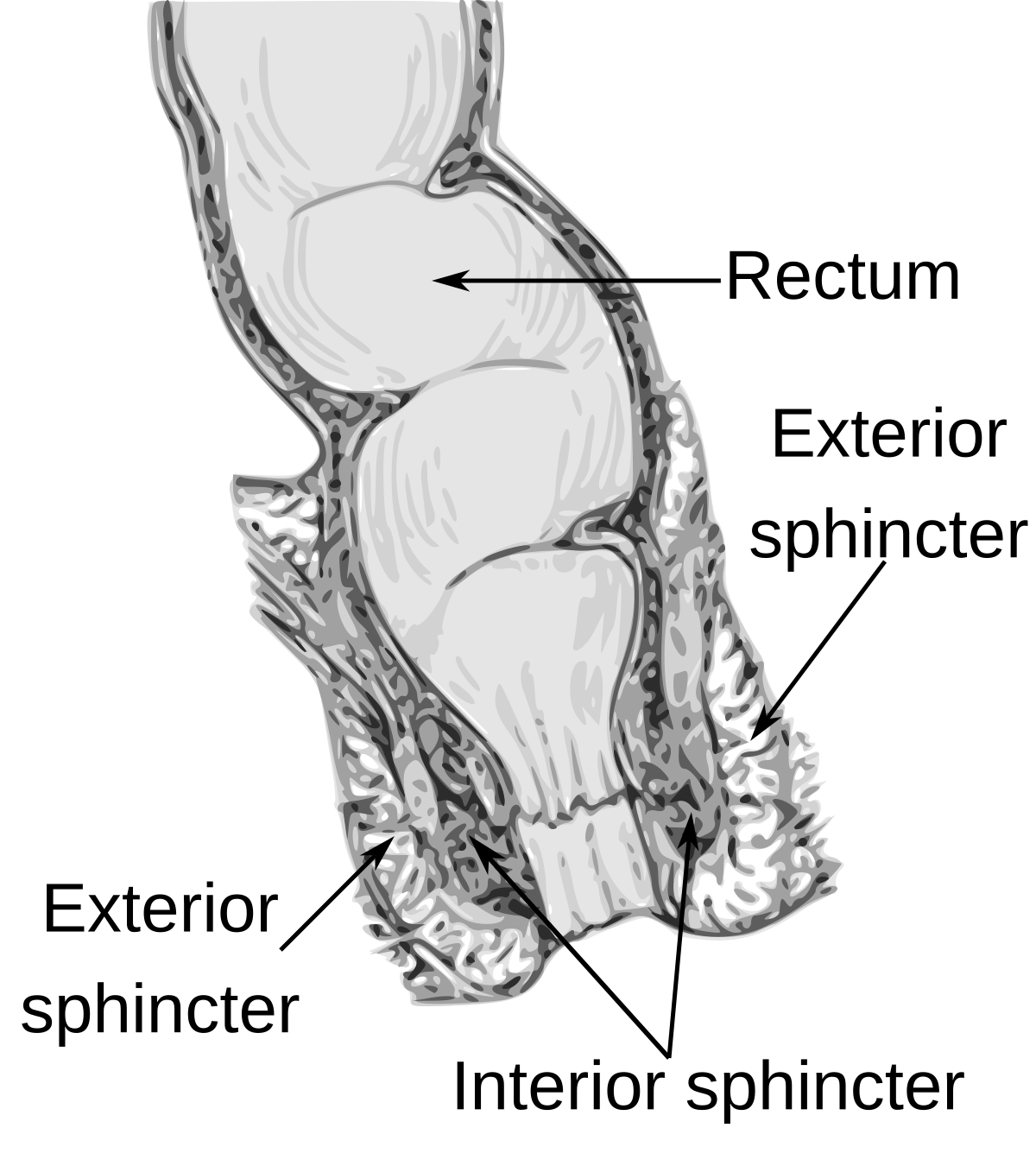 Pathophysiology Of Hemorrhoids In Flow Chart