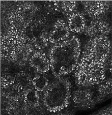 Confocal image of the stratum basale already showing some papillae Confocal image of the stratum basale showing some papillae.jpg