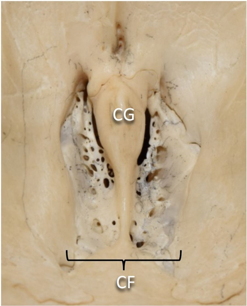 File:Cribriform plate Close-up view.png