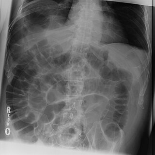 Radiologic sign medical sign from radiology