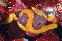 Záběr na žluté červovité tasemnice načlánkovaného těla, které se pohybují ve tkáních svého hostitele