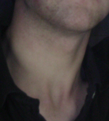 Neck.png