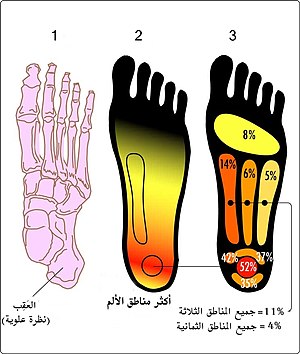 PF-PainAreas-ar.jpg