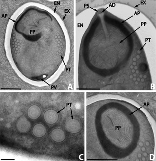 <i>Nosema</i> (microsporidian) Genus of parasitic fungi
