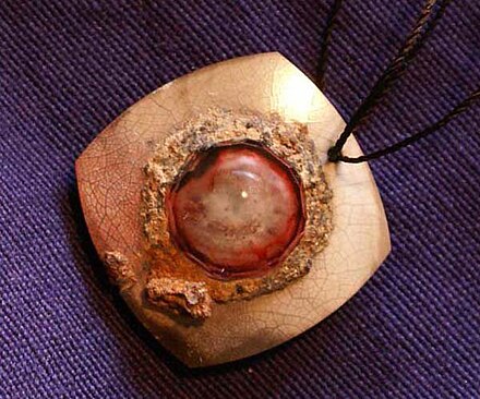 The Ruby Eye Amulet from Mesopotamia, Adilnor Collection, Sweden.