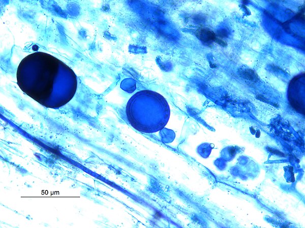 Spore and Vesicles in Vesicular Arbuscular Mycorhizae in root of Macrotyloma uniflorum .
