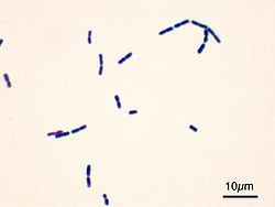 Клетки Bacillus cereus, окрашенные по методу Грама