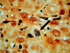 Descrição da imagem Bacteria on Warthin - Starry stain.jpg.