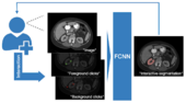 AI-assisted annotation. MONAI Label utilizes AI algorithms to aid researchers and practitioners in medical imaging by providing annotation suggestions based on user interactions. Deepgrow.png