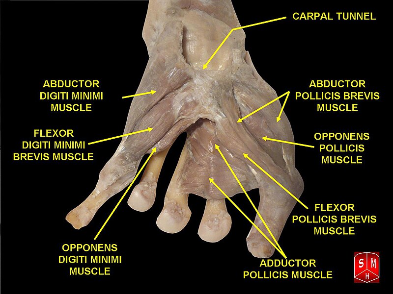 File:Dissection of hand.jpg