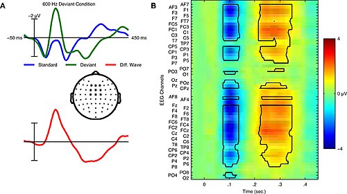 דוגמה לשינויי פוטנציאל הנגרמים בתופעת ה-Mismatch negativity. ניתן לראות את הפוטנציאל קשור-אירוע האופייני בקו האדום בתמונה A. בתמונה B מופיע תרשים המתאר בצבעי כחול-אדום את השתנות הפונטציאל החשמלי כפונקציה של הזמן (ציר אופקי) באלקטרודות שונות ש לה-EEG (מפוזרות על הציר האנכי). לקוח מתוך[19]