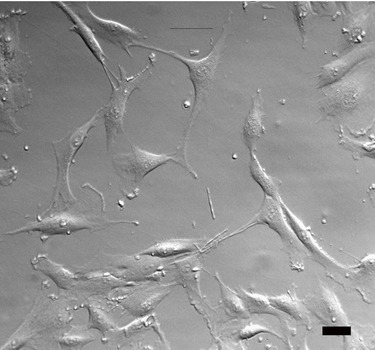 Human meniscus cells via Hoffman modulation contrast. Scale bar=10 mm. Human-meniscus-cells-gruber-et-al-2008.tiff