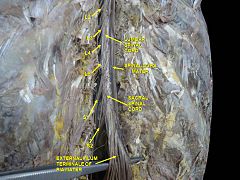 Spinal cord. Spinal membranes and nerve roots.Deep dissection. Posterior view.