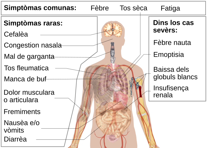 File:Symptoms of coronavirus disease 2019 2.0-oc.svg