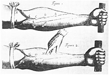 William Harvey's De Motu Cordis, 1628, showed that the blood circulated, contrary to classical era thinking. (Source: Wikimedia)