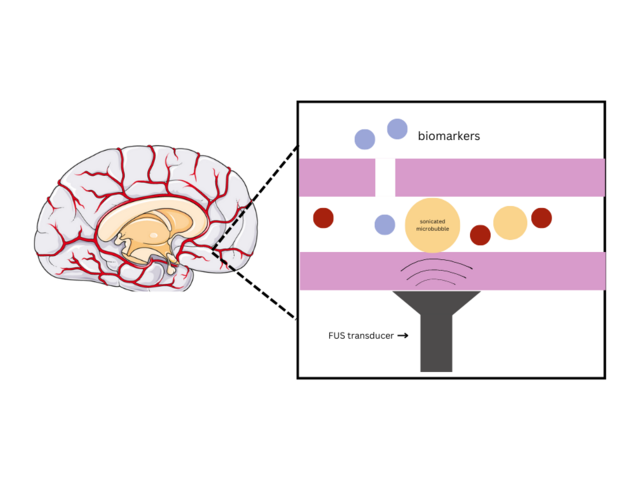 File:Microbubbles and Blood-Brain Barrier Opening.png - Wikipedia