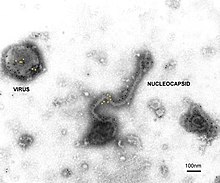 CSIRO ScienceImage 1719 Hendra Virus.jpg