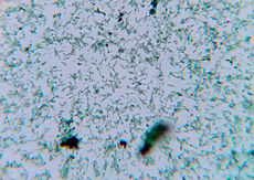 Fotomicrografía de la Corynebacterium diphtheriae luego de 18 horas de cultivo.