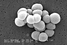 צילום מיקרוסקופ אלקטרונים Micrococcus luteus 9761