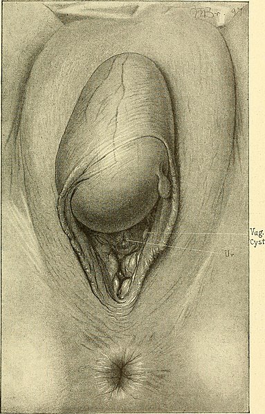 File:Operative gynecology - (1906) (14760517636).jpg