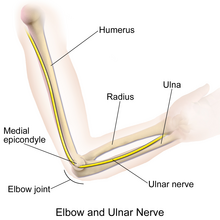 Anatomical location of ulnar nerve, the affected area of the cubital tunnel syndrome. Ulnar Nerve.png