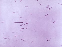 Photomicrograph of Gram-positive, Clostridium tetani bacteria. Note that several of these organisms had entered their endospore phase, assuming the characteristic tennis racket-type morphology.