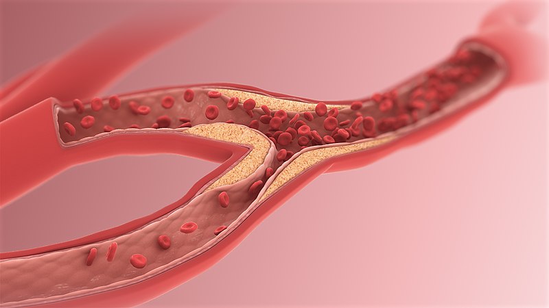 File:Arteriole.jpg