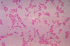 Bacteroides fragilis värvituna Grami järgi