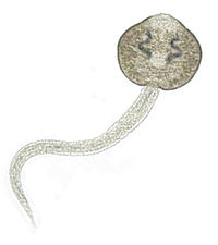 The cercariae of F. magna shed from the snail. Fascioloides magna cercariae.jpg