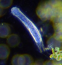 Darkfield photo of a gastrotrich, a worm-like animal living between sediment particles