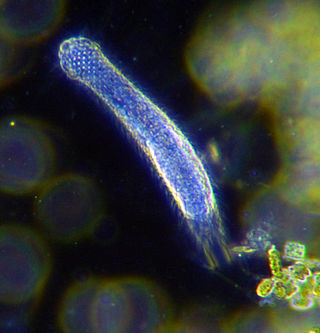 <span class="mw-page-title-main">Gastrotrich</span> Phylum of microscopic animals