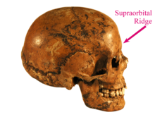 The brow ridges are often not well expressed in human females, as pictured above in a female skull, and are most easily seen in profile. Hallonflickans kranium English Supraorbital Ridge Labeled.png