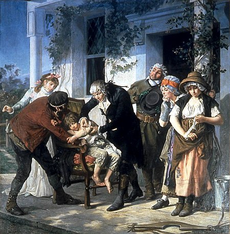 Edward Jenner vaccinating James Phipps, a boy of eight, on 14 May 1796. Jenner failed to use a control group. Melingue Jenner.jpg