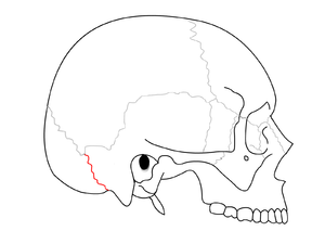 Occipitomastoid suture.png